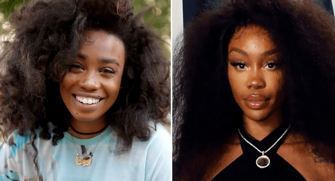 Sza Before Surgery Photos, her Real Name. - Showbiz House