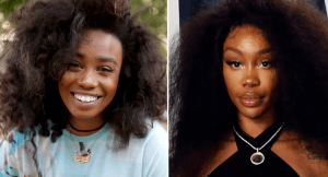 sza before and after surgery photo