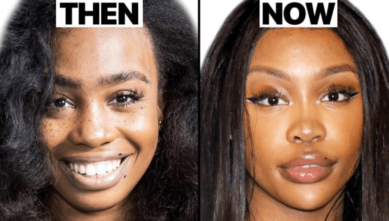 Sza Before Surgery Photos, her Real Name. - Showbiz House